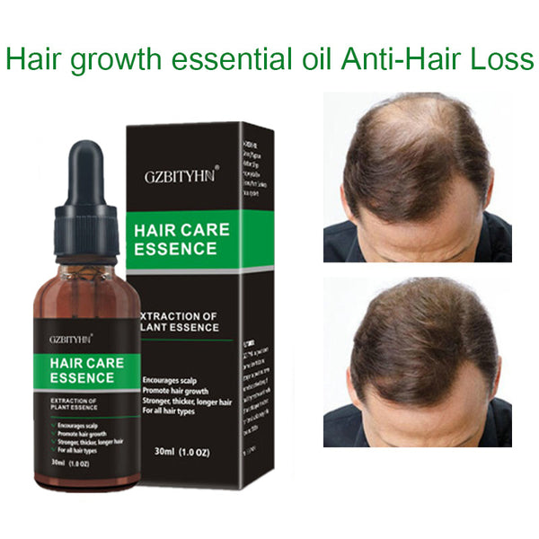 Hair Growth Oil Hair Growth Oil Oem Hair Care Essential Oil - happyshop365247