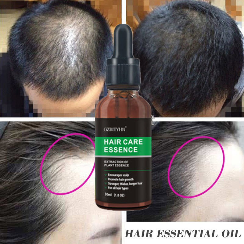 Hair Growth Oil Hair Growth Oil Oem Hair Care Essential Oil - happyshop365247