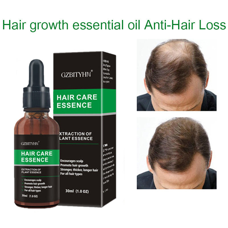Hair Growth Oil Hair Growth Oil Oem Hair Care Essential Oil - happyshop365247